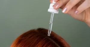 Read more about the article Does Garlic Help with Hair Loss? How to Use Garlic for Hair Growth Fast