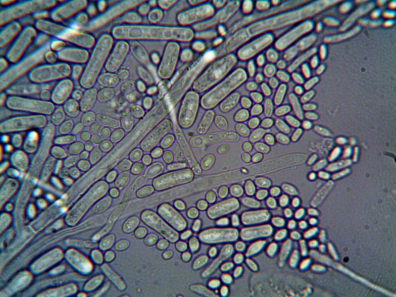 Clostridium botulinum bacteria seen through a microscope