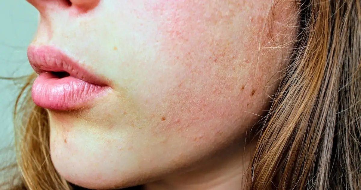 Can You Be Allergic to Garlic? Symptoms, Causes, and What to Do