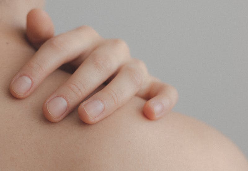 a healthy woman with no symptoms of fungal infection