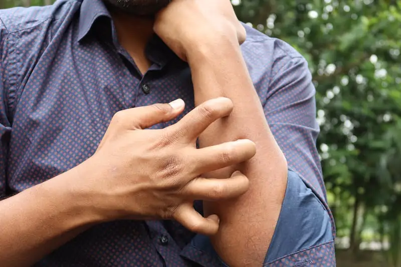 a man with itchy skin - a symptom of garlic allergy